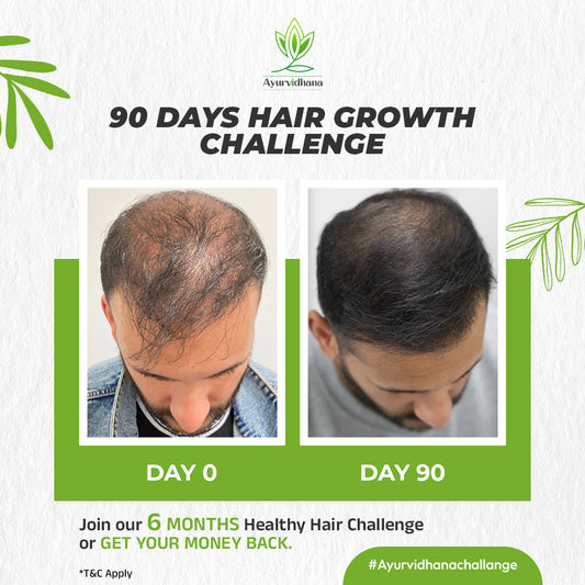 90 Days Hair Growth pack for both men and Women - 500ml